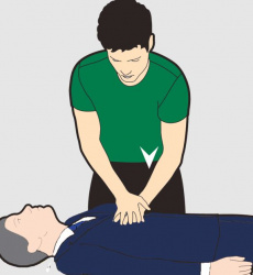 احیای قلبی و ریوی موفق مرد ۶۰ ساله در گرمی